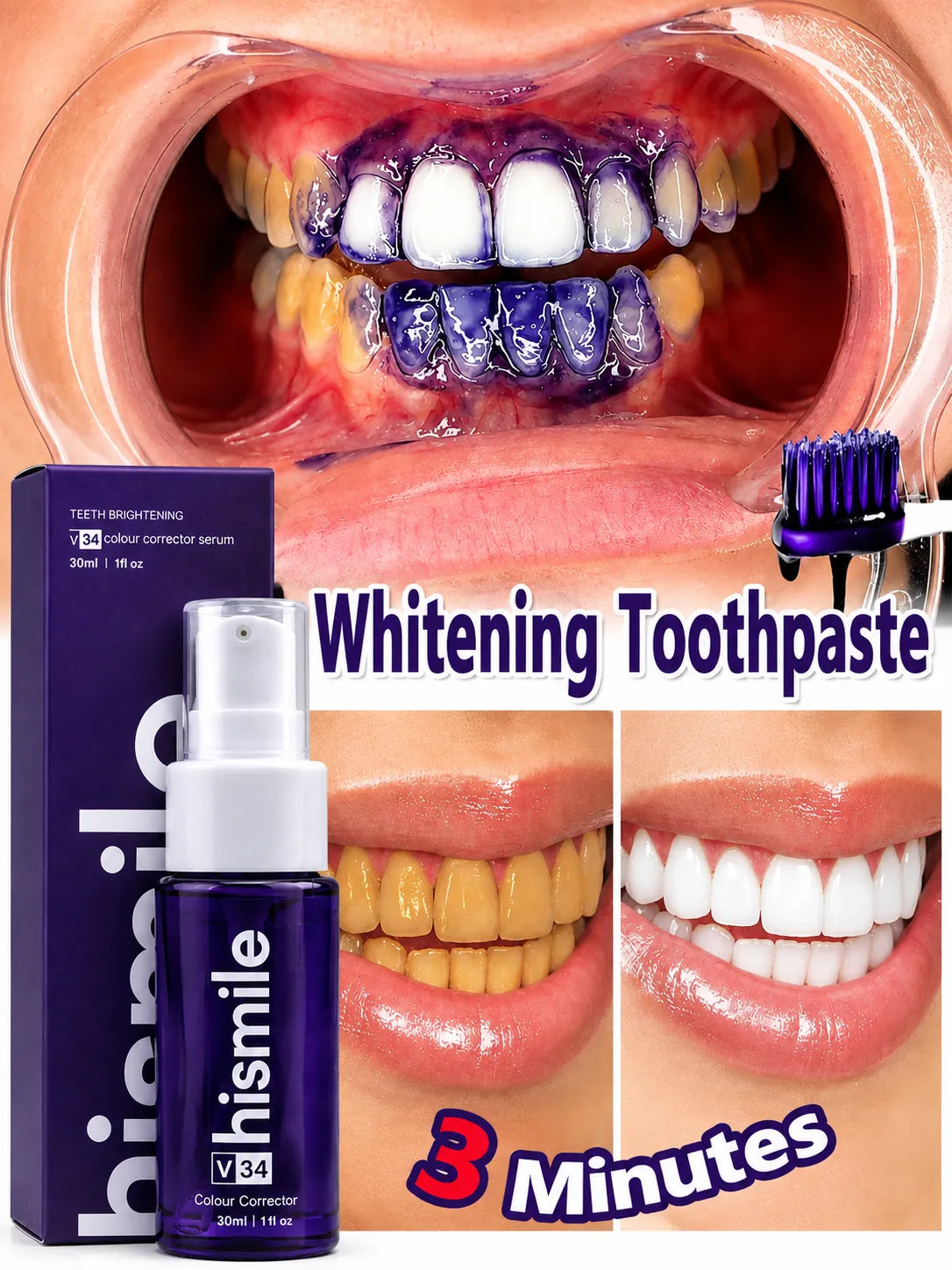 Hismile V34 Teeth Brightening Colour Corrector Serum