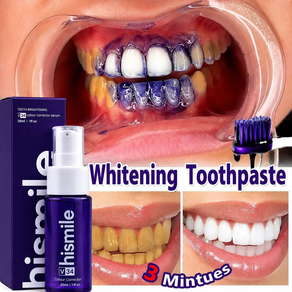 Hismile V34 Teeth Brightening Colour Corrector Serum